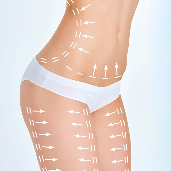 The cellulite removal plan. White markings on young woman body.