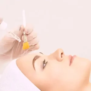 Chemical peels. Young woman cleaning face skin in salon retinol peel with brush acid organic peeling